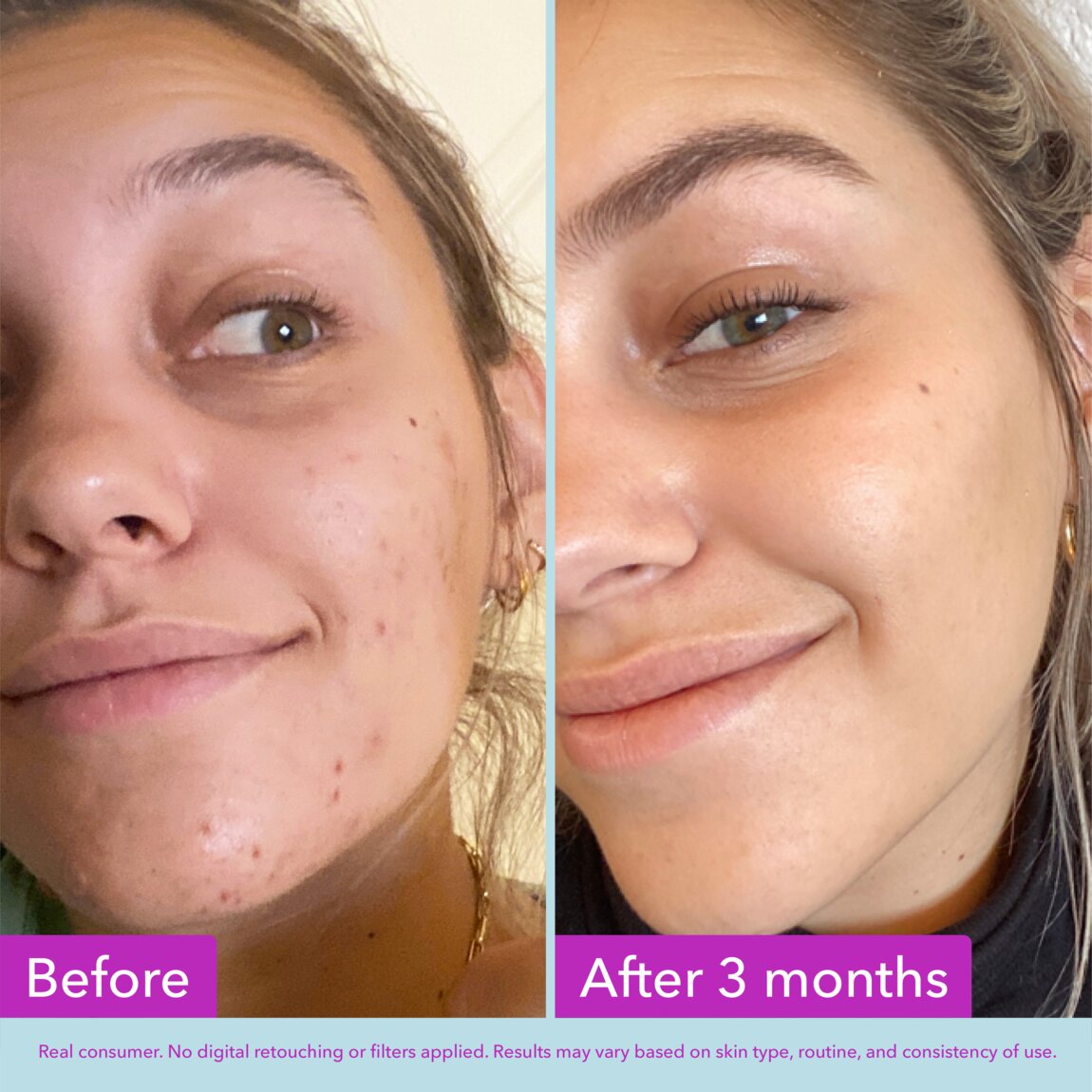 niacinamide-brightening-toner-o6 zb_p.jpg