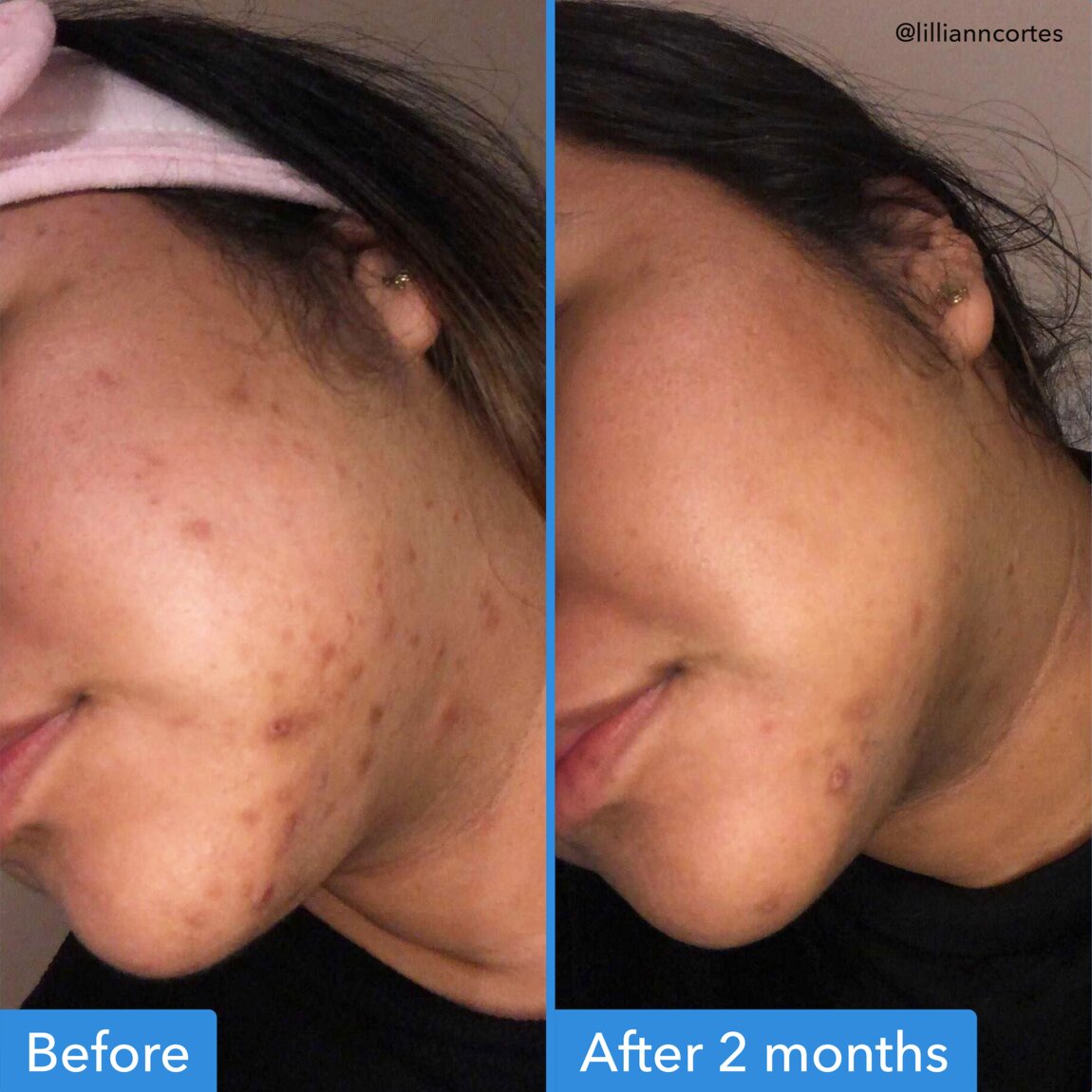 discoloration-correcting-serum-y7 zb_p.jpg