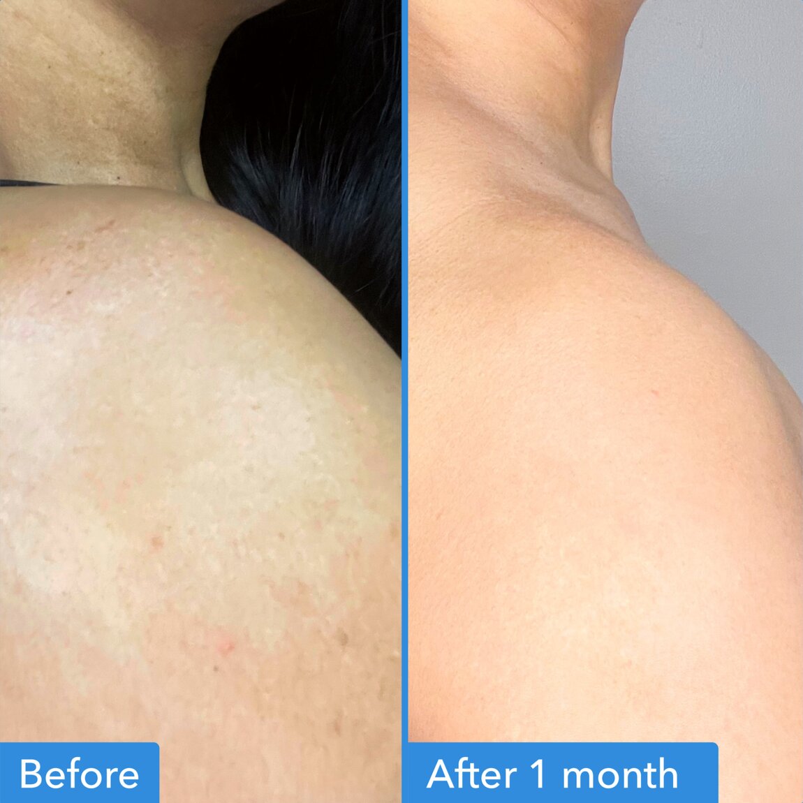 discoloration-correcting-body-treatment-k4 zb_p.jpg
